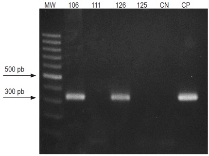 Amplificaci&oacute;n del ORF S de VHB (nt. 423-759) en las muestrasde tejido hep&aacute;tico. Tama&ntilde;o esperado: 336 pb. Se utiliz&oacute; un marcador depeso de 100 pb, y se indican las posiciones correspondientes a 300 y 500pb. CN: control negativo; CP: control positivo