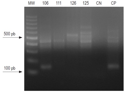 Amplificaci&oacute;n del ORF X de VHB (nt. 1411-1549) en lasmuestras de tejido hep&aacute;tico. Tama&ntilde;o esperado: 139 pb. Se utiliz&oacute; unmarcador de peso de 100 pb, y se indican las posiciones correspondientesa 100 y 500 pb. CN: control negativo; CP: control positivo.