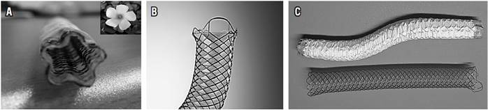 Tipos de stents cubiertos utilizados en el estudio. A. SF cubierto de forma pentagonal con surcos orientados en paralelo a lo largo de su eje mayor. B.Stent met&aacute;lico est&aacute;ndar de Boston Scientific, Wallstent, de forma cil&iacute;ndrica y totalmente cubierto. C. El SF (en la parte superior) presenta una mayor conformabilidad (conserva la forma en S) con una menor FR y FA con respecto al SC.