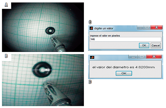 C&aacute;lculo del tama&ntilde;o de un objeto conocido en mil&iacute;metros. A. Foto de un objeto conocido (anillo de caucho), ya ingresada al algoritmo. B. Haciendo uso de la funci&oacute;n &ldquo;imdistline&rdquo;, se utiliza el proceso ya conocido, se le traza la l&iacute;nea y se obtiene el valor en p&iacute;xeles. C. Se ingresa el valor en p&iacute;xeles y dando clic en &ldquo;OK&rdquo; arroja el resultado en mil&iacute;metros.
