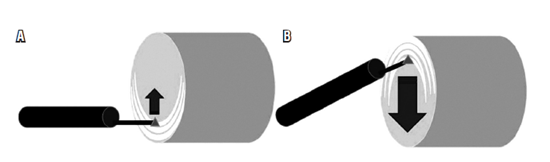 V&iacute;as para la realizaci&oacute;n de POEM (6). A. Posterior B. Anterior.