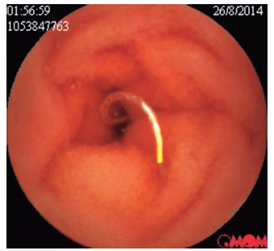 Parásito intestinal.