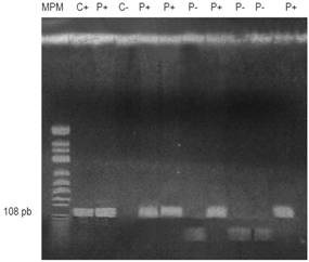 Corrida del gen APC muestra el carril 1: marcador de peso molecular (MPM); carril 2: control positivo (C+); carriles: 3, 5, 6, 8 y 11: pacientes positivos (P+); carril 4: control negativo (C-); carriles 7, 9 y 10: pacientes negativos (P-). pb: pares de bases.