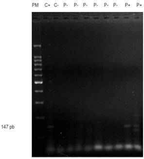 Gel de agarosa muestra corrida del gen P15. El carril 1 muestra marcador de peso molecular; el carril 2: control (+); carril 3: control (-); carriles 4-9: pacientes (-); carriles 10 y 11: pacientes (+).