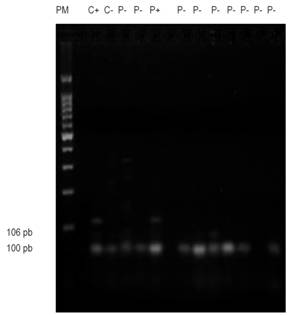 Gel de agarosa muestra corrida del gen E-cadherin. M: marcador de peso molecular 100 pb, C+: control positivo, C-: control negativo, P+: paciente positivo, P-: paciente negativo.