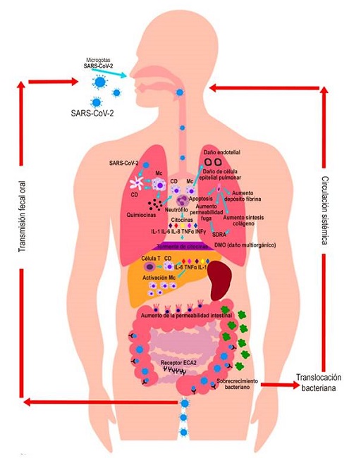 Mecanismos de transmisión y afectación en órganos blanco. Se presenta una afectación pulmonar grave por el virus causada por la hiperinflamación y un cuadro similar a la HLH. Esta respuesta inmune altamente activada causa una liberación exagerada o tormenta de citocinas. Además del contagio por gotas y aerosoles, se ha documentado transmisión fecal-oral, sustentando la presencia de síntomas gastrointestinales en COVID-19. CD: célula dendrítica; Mc: macrófagos. Diseñado por Dra. Viviana Parra-Izquierdo; graficado por Ana María Ocaña.