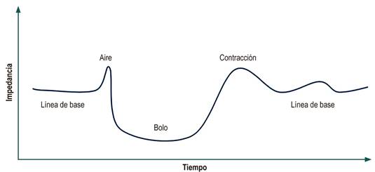 Representaci&oacute;n del bolo entre 2 electrodos de impedancia, hecho que inicialmente registra un aumento de la impedancia por el aire que abre paso al bolo en el es&oacute;fago, con un posterior descenso r&aacute;pido de la impedancia cuando el bolo se ubica entre los dos electrodos; luego, se registra un aumento de la impedancia que corresponde a la contracci&oacute;n esof&aacute;gica generada por el impulso del bolo, con un posterior retorno progresivo a la l&iacute;nea de base de la impedancia a medida que el bolo va siendo aclarado del segmento entre los 2 electrodos 10.