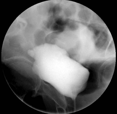 Voiding cystography. Authors’ archives.