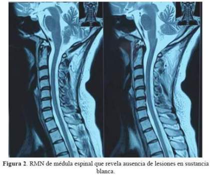 Figura 2.