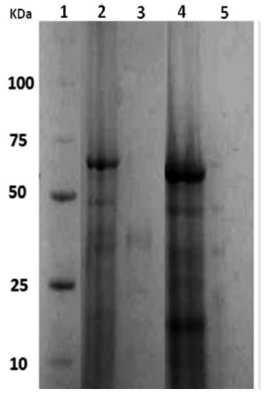 Electroforesis en geles de poliacrilamida de los extractos proteicos de la FM y FC de P. luteola crecida en MMM con CD o con antraceno como &uacute;nica fuente de carbono. 1: marcadores de peso molecular; 2 y 3: FM y FC de P. luteola crecida con CD, respectivamente; 4 y 5: FM y FC de P. luteola crecida con antraceno, respectivamente.