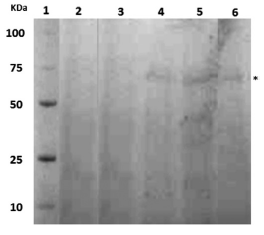 Electroforesis en geles de poliacrilamida de los extractos proteicos de la fracci&oacute;n de membrana de P. luteola crecida en medio con diesel como &uacute;nica fuente de carbono (MMMD) a distintos tiempos de inoculaci&oacute;n. 1: marcadores de peso molecular; 2, 3, 4, 5 y 6: incubaciones a 1, 2, 4, 5 y 6h, respectivamente. El asterisco indica la presencia de la prote&iacute;na p70kDa.