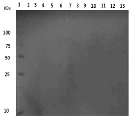Electroforesis en geles de poliacrilamida de los extractos proteicos de la fracci&oacute;n de membrana de P. luteola crecida con antraceno como &uacute;nica fuente de carbono (MMMA) a distintos tiempos de inoculaci&oacute;n. 1: marcador de peso molecular; 2: medio de cultivo no inoculado; 3 al 13: FM de las incubaciones a las 0, 1, 2, 3, 4, 5, 6, 7, 8, 9, 10 y 11h, respectivamente.