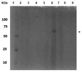 Electroforesis en gel de poliacrilamida de los extractos proteicos de la FM de P. luteola crecida en los MMMA, MMMAP a distintos tiempos de inoculaci&oacute;n. 1: marcadores de peso molecular; 2, 4 y 6: FM de las incubaciones en MMMA, a las 22, 23 y 24h, respectivamente; 3, 5 y 7: FM de las incubaciones en MMMAP a las 22, 23 y 24h, respectivamente; 8 y 9: medios de cultivo no incubados. El asterisco indica la presencia de la prote&iacute;na p70kDa.