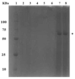 Electroforesis en geles de poliacrilamida de los extractos proteicos de la fracci&oacute;n de membrana de P. luteola crecida con antraceno y peptona como fuentes de carbono (MMMAP) a distintos tiempos de inoculaci&oacute;n. 1: marcadores de peso molecular; 2 al 8: FM de las incubaciones a las 23, 25, 28, 33, 38, 43 y 49h, respectivamente. El asterisco indica la presencia de la prote&iacute;na p70kDa.