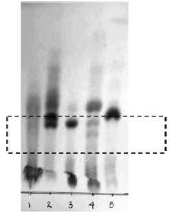 Crude extract Silica-TLC of pink corn compared with anthocyanin standards. 1: Rose corn kernel, 2: purple corn kernel, 3: Cyanidin-3-glucoside
standard from jaboticaba, 4: Pelargonidin-3-glucoside standard from strawberry, 5: Cyanidin-3-(6
malonyl) glucoside standard from purple lettuce. Elution system: etil acetate:
water: formic acid (75:20:10).