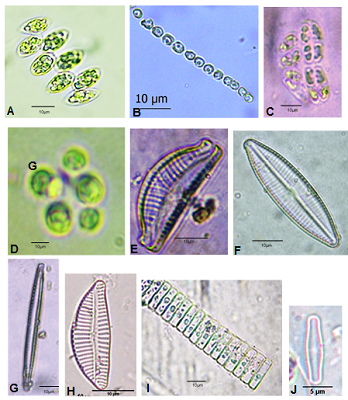 Microfotografas de algunas microalgas identificadas en los ambientes lnticos altoandinos evaluados del departamento de Pasco. A. Scenedesmus sp., B. Radiofilum sp., C.      Crucigeniella cf. rectangularis, D. Pandorina sp., E. Epithemiasorex, F. Navicula sp., G. Nitzschia sp., H. Encyonema sp., I. Fragilariaceae, J. Achnanthidium.