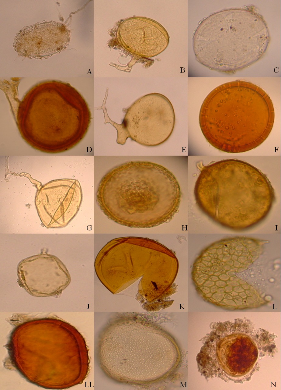 Morfotipos de esporas de hongos micorrízicos arbusculares, género Glomus
(A-J), género Acaulospora (K-M), género Entrophospora (N).