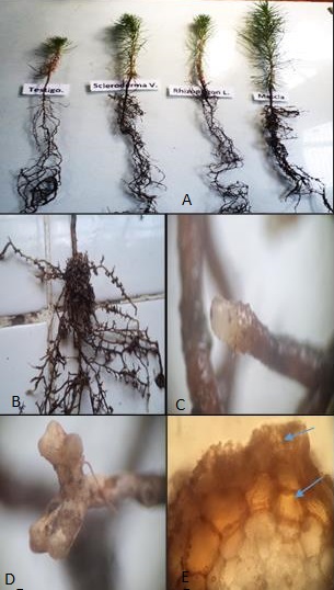 (A) Desarrollo de la parte area y radicular de plantas de Pinus radiata D. Don; (B) raz micorrizada; (C) micorrizas monopodiales; (D) micorrizas dicotmicas; (E) corte longitudinal donde se observa el manto fngico y la red de Harting