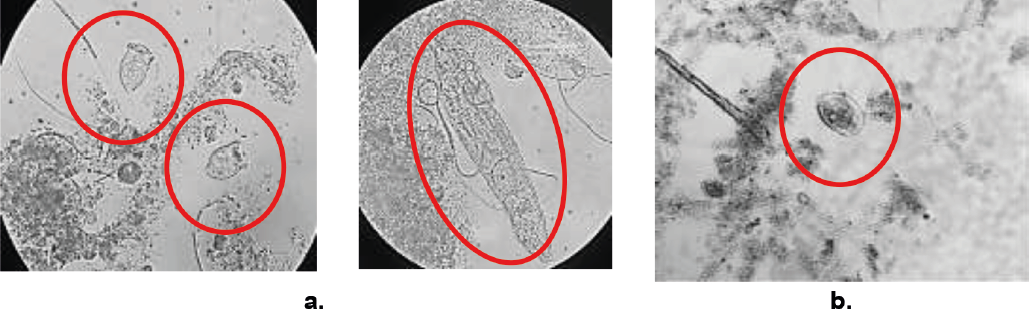 Protozoos encontrados con mayor abundancia en la biomasa del reactor SBR. a) Ciliado fijo y Rot�fero con C1. b) Ciliado libre con C2.