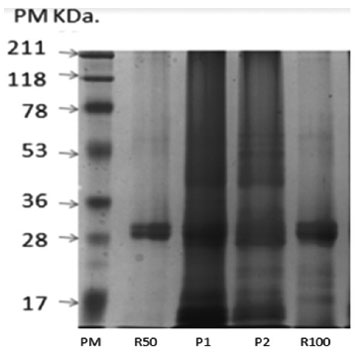 Electroforesis de los cuatro ant&iacute;genos probados en la estandarizaci&oacute;n