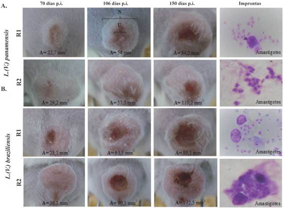 Lesiones producidas en ratones BALB/c infectados con Leishmania. Fotograf&iacute;a de las lesiones cut&aacute;neas de ratones (R1 y R2) infectados con L. (V.)panamensis(A.) y de ratones (R1 y R2) infectados con L. (V.) braziliensis(B.), 70, 106 y 150 d&iacute;as post-infecci&oacute;n. En la &uacute;ltima columna, se muestran microfotograf&iacute;as (aumento 1000X) de improntas de las lesiones con amastigotes. A: &aacute;rea del n&oacute;dulo en mm2. N:n&oacute;dulo, U:&uacute;lcera