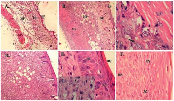 Caracter&iacute;sticas histopatol&oacute;gicas de lesiones producidas por L. (V.)panamensis.A. Piel normal; B. 70 d&iacute;as p.i. infiltrado inflamatorio en la hipodermis, aumento 100X; C. La flecha indica macr&oacute;fagos infectados, 1000X; D. 106 d&iacute;as p.i, infiltrado inflamatorio difuso con abundantes amastigotes (recuadro), 400X; E. 150 d&iacute;as p.i Alteraciones en epidermis 1000X. F. Perdida uni&oacute;n dermo-epid&eacute;rmica, 1000X. EP: epidermis, DE: dermis, HP: hipodermis, MS: m&uacute;sculo, IF: infiltrado inflamatorio, ES: espongiosis, HQ: hiperqueratosis, AC: acantosis, (*): amastigotes. Las biopsias fueron analizadas por dos observadores, K de 0,6 con un grado de acuerdo sustancial