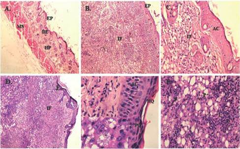 Caracter&iacute;sticas histopatol&oacute;gicas de lesiones producidas por L. (V.) braziliensis.A. Piel normal; B. 70 d&iacute;as p.i. infiltrado inflamatorio difuso, aumento 100X; C. 106 p.i., proliferaci&oacute;n celular en epidermis e infiltrado inflamatorio 400X; D. 150 d&iacute;as p.i. infiltrado inflamatorio difuso; E. Alteraci&oacute;n en la epidermis, acantosis, aumento 1000X; F. La flecha indica un macr&oacute;fago infectado, infiltrado inflamatorio de linfocitos bas&oacute;filos y plasmocitos, aumento 400X. EP: epidermis, DE: dermis, HP: hipodermis, MS: musculo, IF: infiltrado inflamatorio, PQ: paraqueratosis, HQ: hiperqueratosis, AC: acantosis, L: linfocitos, P: c&eacute;lulas plasm&aacute;ticas. K de 0,7 con un grado de acuerdo sustancial.