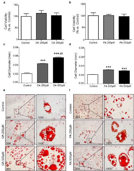 Effect of Oleate and Palmitate treatment on 3T3L1 adipocytes Cell viability graphs after a OLA or b PAM 250 μM and 500 μM treatment on adipocytes Cell diameter graphs after c OLA or d PAM at different concentrations Cells morphology with oil red O staining after e OLA or f PAM treatment Data are represented as % cell viability vs control 100% Bar graphs represent control cells white 250 μM grey and 500 μM black Values are the mean  SEM Differences between groups were analysed by oneway ANOVA followed by Scheffe test ***P0001 vs Control ## p  001 vs 250 μM OLA concentration
