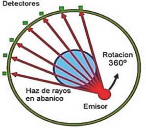 Funcionamiento básico del equipo de tomografía o tomógrafo (González-Arias, 2012).