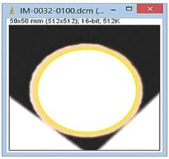Visualización con el software ImageJ de la selección del área de la muestra tipo plug donde se usa una de las herramientas de selección de forma circular y tomamos solo el área de la muestra tipo plug con el fin de que no tenga en cuenta datos que no pertenezcan a la misma.