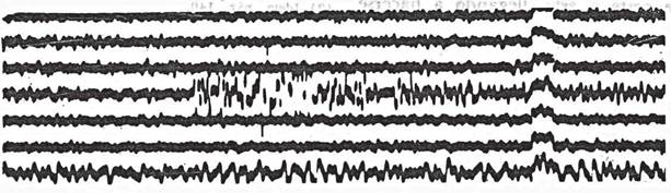 Historic record of the 1971 earthquake recorded by the Observatorio de la Plata by one short-period seismometer.The recording shows an upwards jump in the waveform on the 4th time line. Scale is 1:1.9 in the vertical and 1: 1.9 mm in thehorizontal (Jaschek, 1972).