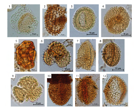 Angiosperm taxa found in the study. 1. Afropollis jardinus (T8-2, 47728; Hollín Formation); 2. Baculamonocolpites sp. (D8-3, 47732; Hollín Formation); 3. Clavatipollenites hughesii (F26-1, 47725; Hollín Formation); 4. Cornetipollis perforatus (P37-1, 47725; Hollín Formation); 5. Cretacaeiporites sp. (T14, 47723; Hollín Formation); 6. Droseridites senonicus (O17-3, 46432; Chipaque Formation); 7. Echimonocolpites sp. (U22, 47725; Hollín Formation); 8. Pennipollis peroreticulatus (D3-4, 47728; Hollín Formation); 9. Retitricolpites operculatus (P17, 47720; Hollín Formation); 10. Stellatopollis barghoornii (J36-4, 47728; Hollín Formation); 11. Stellatopollis densiornatus (V7-3, 46872; Hollín Formation); 12. Stellatopollis dubius (Q30-1, 44889; Hollín Formation).