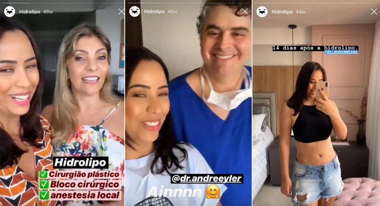 Sequência de colagens de vídeo de procedimento estético publicado no Instagram