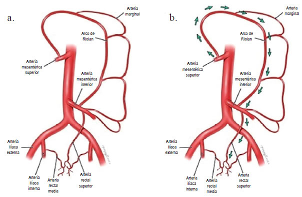 a. Vías de circulación visceral colateral, en oclusión aortoilíaca. b. Ramas de la arteria mesentérica 
    superior; arco de Riolan; arteria marginal de Drumond; arteria rectal superior; arteria rectal  media; arteria iliaca interna.  Reproducido y traducido con autorización de: Anatomical significance in aortoiliac  occlusive disease.
    Clin Anat. 2014;27:1264-74