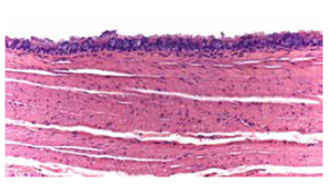 Revestimiento del quiste por un epitelio bronquial de tipo ciliado. Hematoxilina y eosina, 20X.