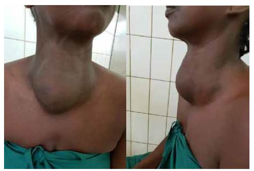 Vista frontal y lateral de la paciente en consulta externa.