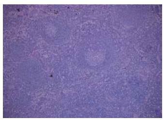 Ganglio linfático estación 4 R. Hematoxilina y eosina 10x.