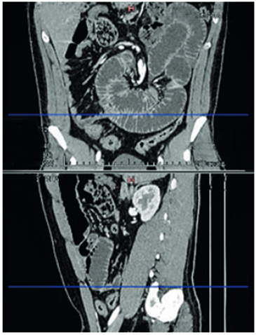 Zona de transici&oacute;n a nivel de &iacute;leon.