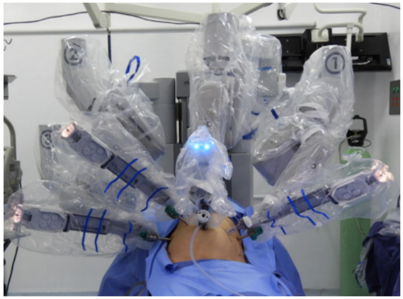 “Docking” con plataforma da Vinci® Si en gastrectomía asistida por robot.