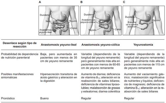 Tipos de resección intestinal y resultados asociados.