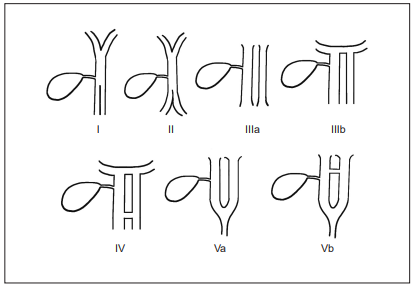 Adaptaci&oacute;n de la clasificaci&oacute;n original de Choi de la duplicaci&oacute;n del conducto col&eacute;doco, publicada con permiso de Elmer Press Production de la publicaci&oacute;n de Kolli S, Etienne D, Reddy M, Shahzad G. A review of double common bile duct and its sequelae. Gastroenterology Res. 2018;11:1-4