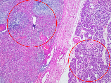 Tejido espl�nico (pulpa blanca y roja) vecino a par�nquima pancre�tico normal. Tinci�n de hematoxilina y eosina. 4X.