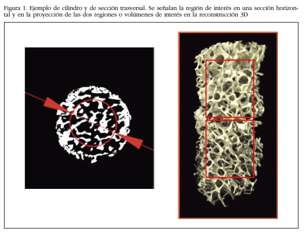 Ejemplo de cilindro y de sección trasversal. Se señalan la región de interés en una sección horizontal
y en la proyección de las dos regiones o volúmenes de interés en la reconstrucción 3D
