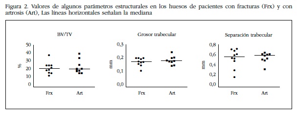 Valores de algunos parámetros estructurales en los huesos de pacientes con fracturas (Frx) y con
artrosis (Art), Las líneas horizontales señalan la mediana
