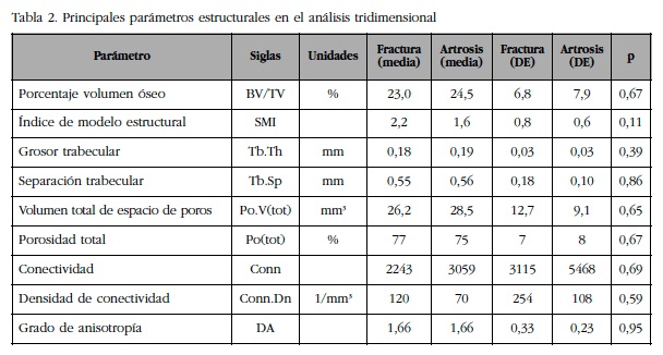Principales parámetros estructurales en el análisis tridimensional