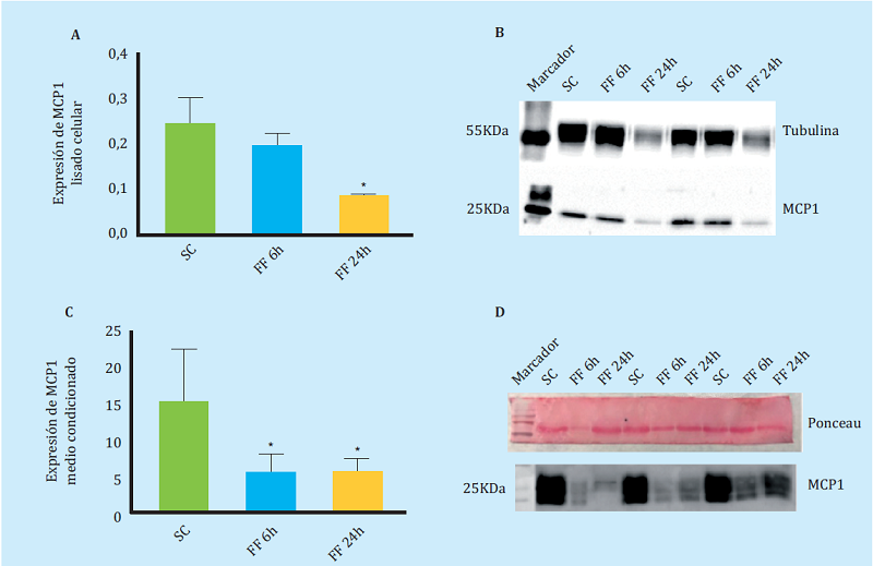 ecreción y expresión de proteínas quimiotácticas medidas por Western Blot (A-C). Expresión de la proteína MCP1 en lisado celular de MLO-Y4 en ausencia de estímulo mecánico (SC) y tras 6 y 24 horas de realizar FF durante 10 minutos (FF6h y FF24h) (C-D). Secreción de la proteína MCP1 en medios condicionados de MLO-Y4 en ausencia y presencia de estímulo mecánico (E-F). Expresión de HMGB1 en lisado celular de MLO-Y4 en ausencia y presencia de estímulo mecánico (G-H). Expresión de RANTES en lisado celular de MLO-Y4 en ausencia y presencia de estímulo mecánico. Los valores densitométricos relativos son la media ± desviación estándar de 2 experimentos independientes por triplicado. *p<0,05 vs. control estático