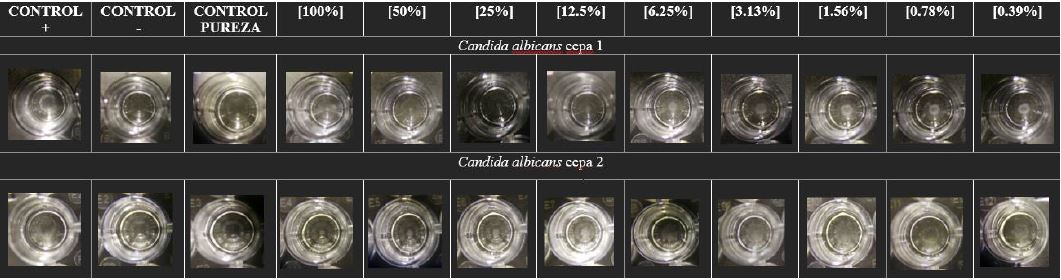 Tamaño de los botones de crecimiento de C. albicans frente a la actividad del veneno crudo diluido de H. charcasus y controles positivo y negativo