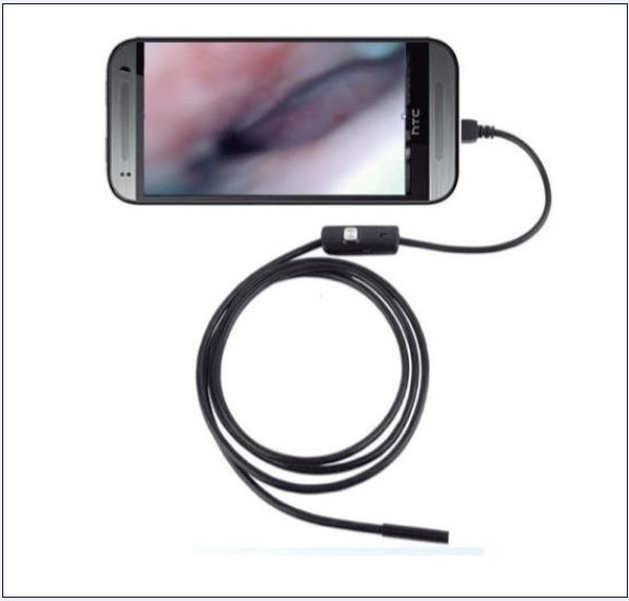 Esquema de nasolaringofibroscopio portátil asistido por teléfono inteligente.