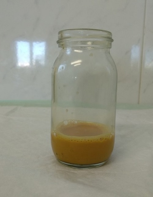 S&iacute;ndrome de rusty-pipe o de las tuber&iacute;as oxidadas: aspecto de la leche extra&iacute;da (d&iacute;a 3)