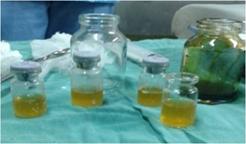 Imagen del líquido obtenido en la punción pleural